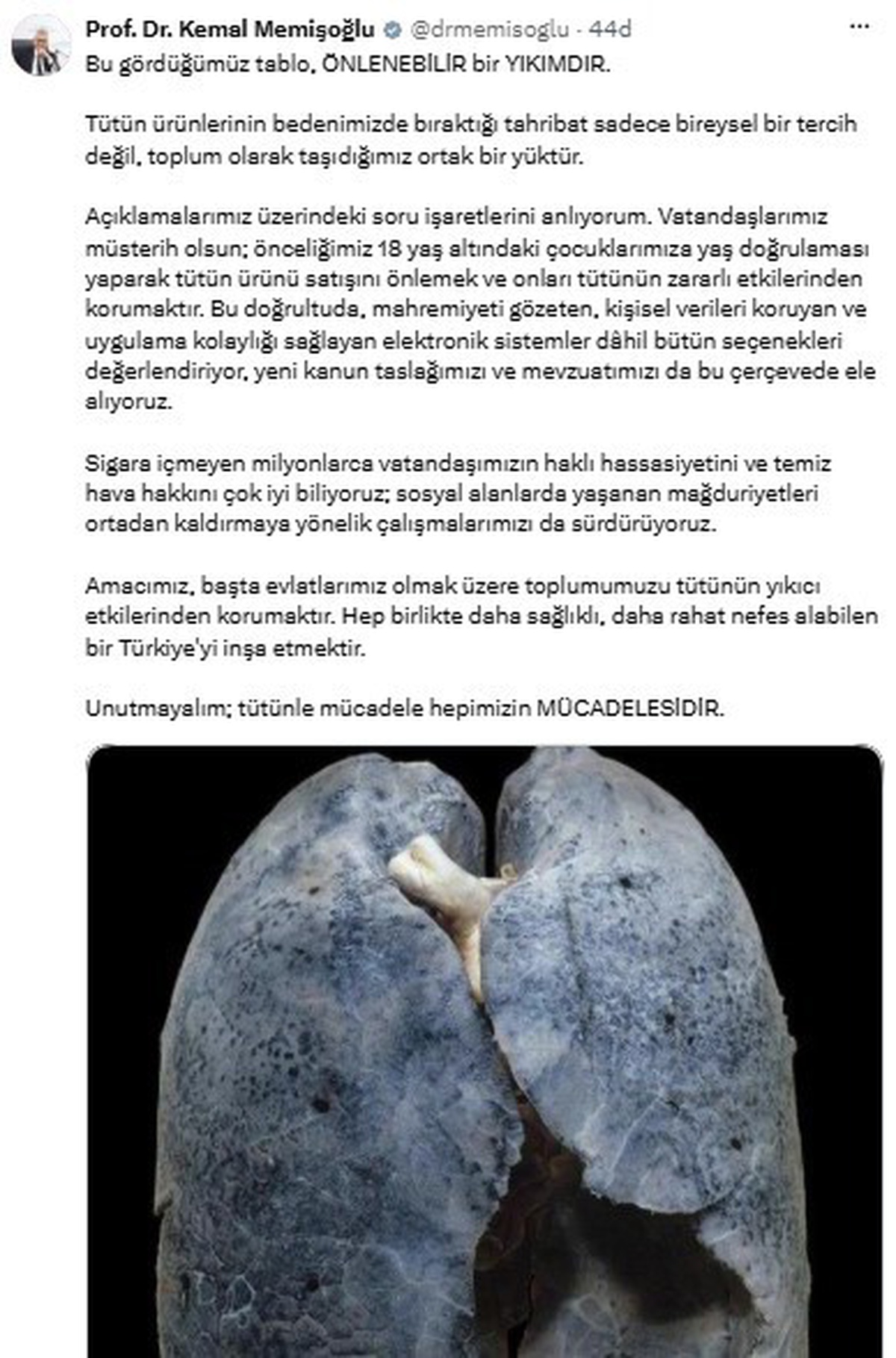 Bakan Memişoğlu, tütün satışında 18 yaş altına yaş doğrulaması yapacaklarını açıkladı