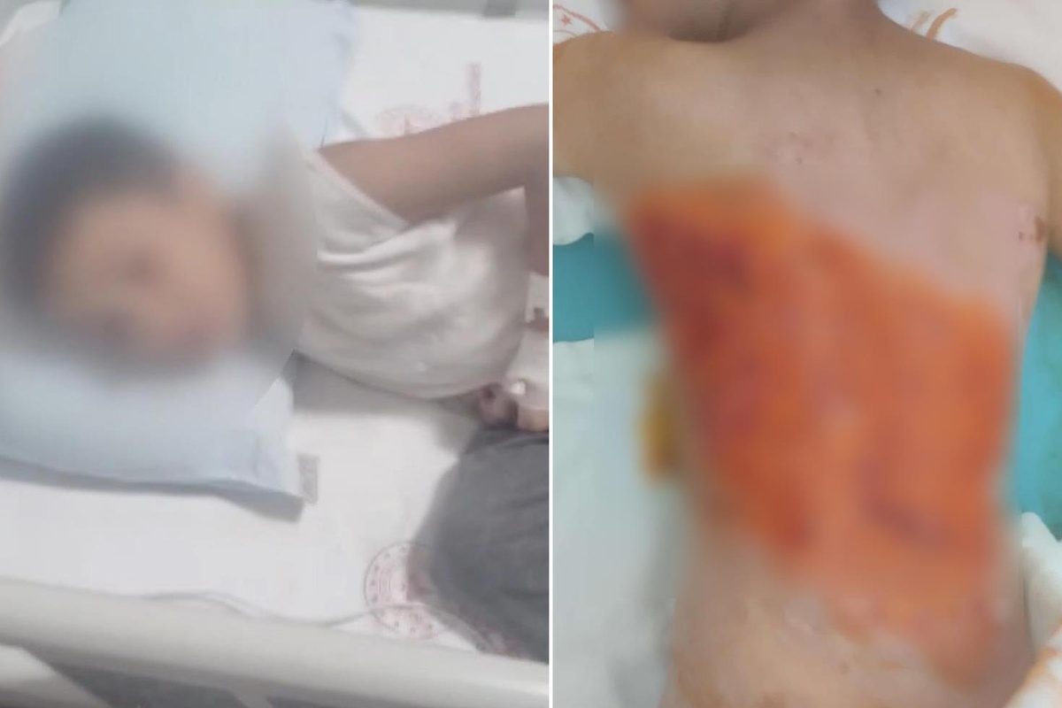 12 yaşındaki çocuğu diri diri yaktılar! Sonrası daha da korkunç