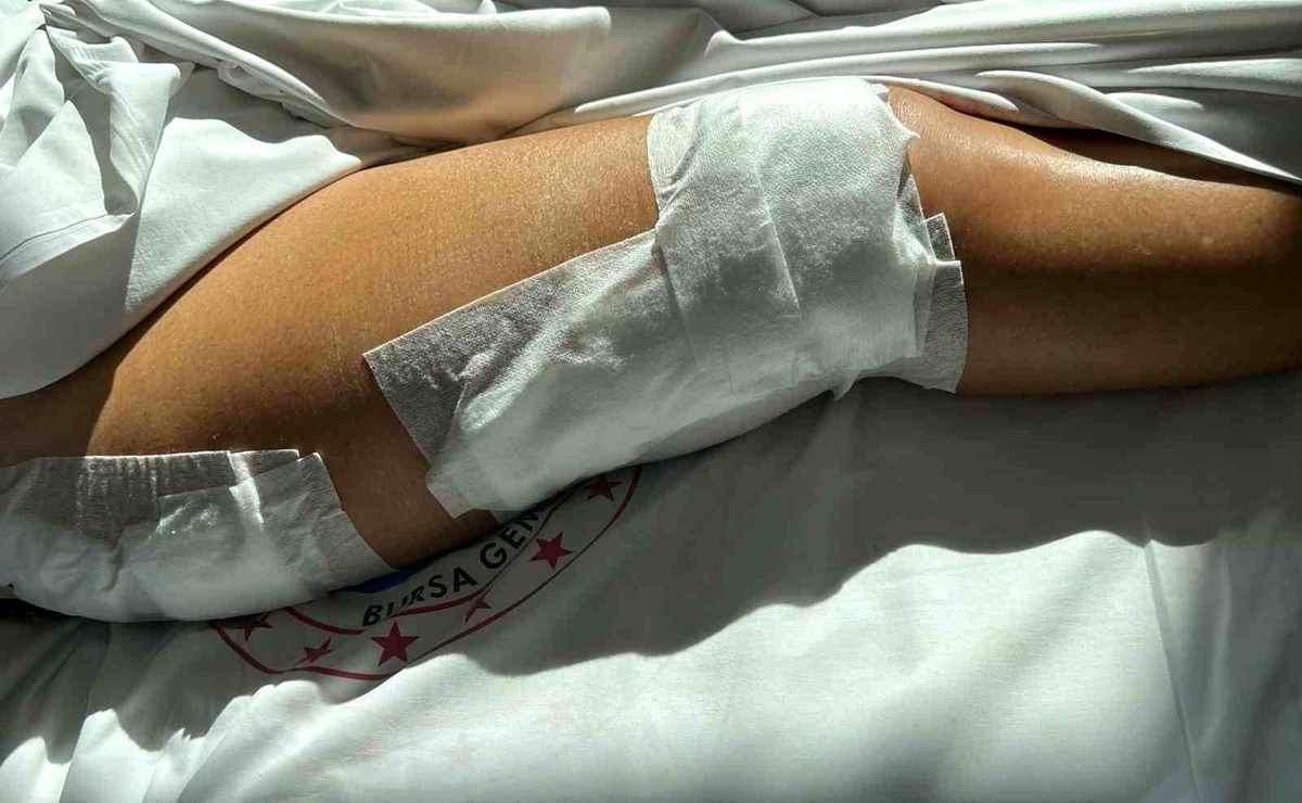 [YEREL / KAMU · Yalova · Armutlu] Yalova'da Tekne Çarpması Sonucu 70 Yaşındaki Kadın Ağır Yaralandı