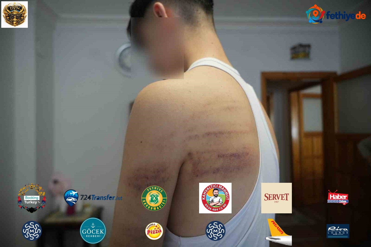 Niğde'de çırağını darp ettiği iddiasıyla gözaltına alınan işletme sahibi tutuklandı