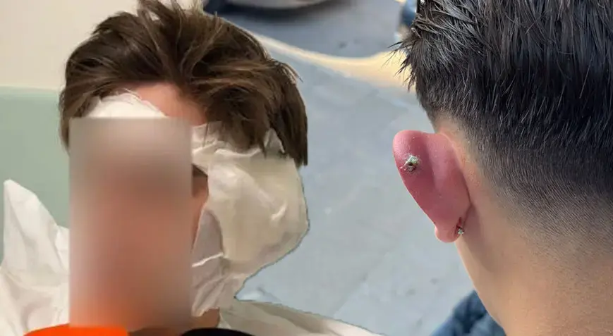 Kulağına piercing taktırdı, hayatı kabusa döndü! 5 gecedir hastanede