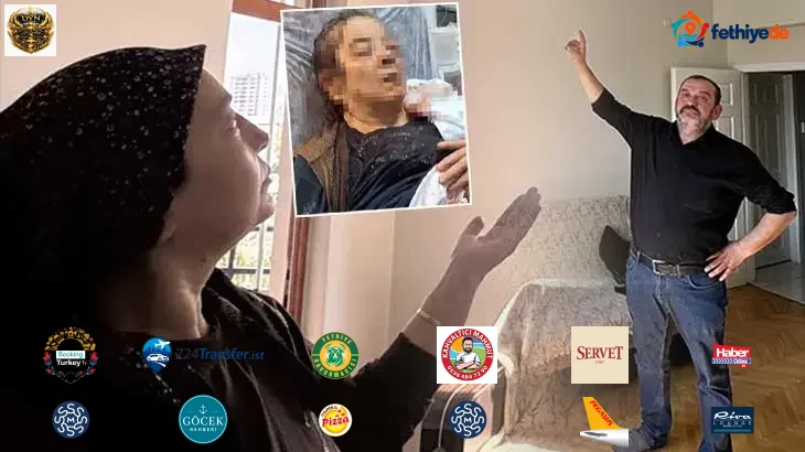 Çayını içip televizyon izliyordu, gözünü kaybetti: Bunu yapan insan nasıl yapmış, hayretler içindeyiz
